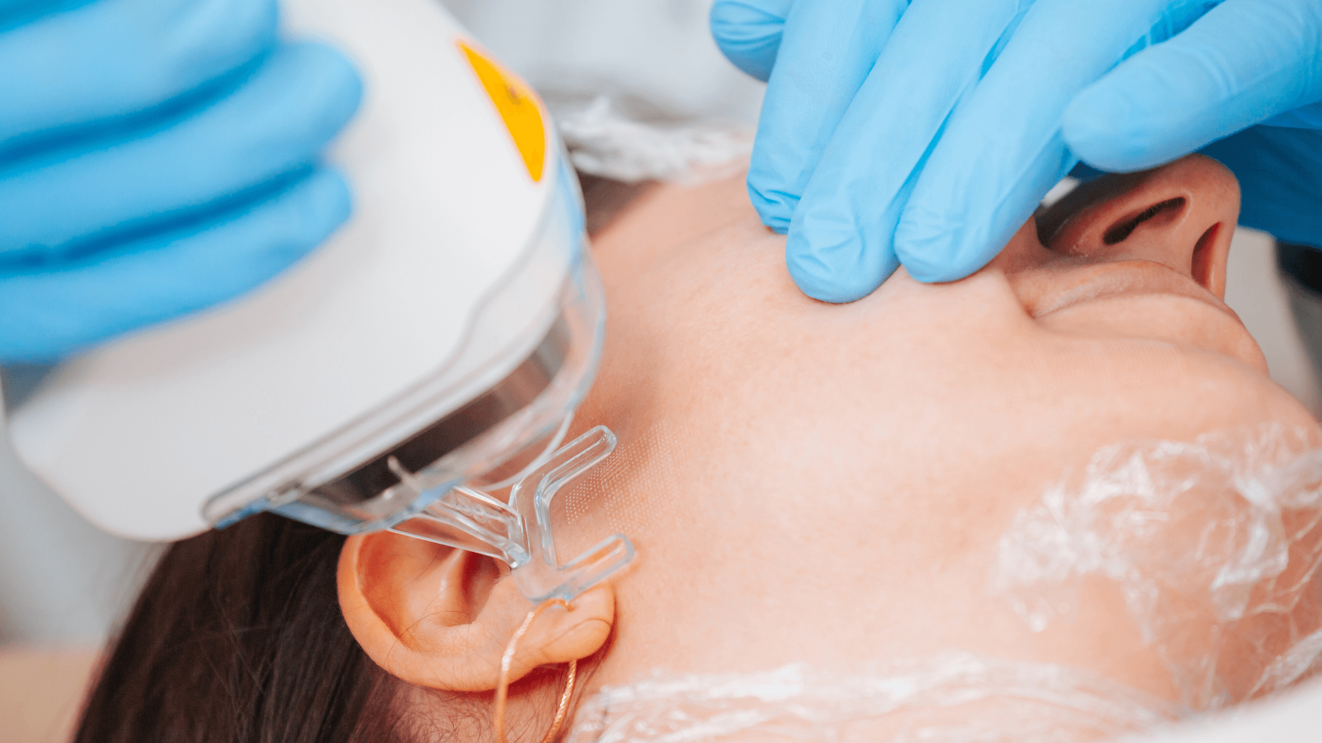 Understanding Laser Resurfacing: And What Makes LaseMD Ultra Different